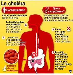 Le Choléra qu’est-ce que c’est ?