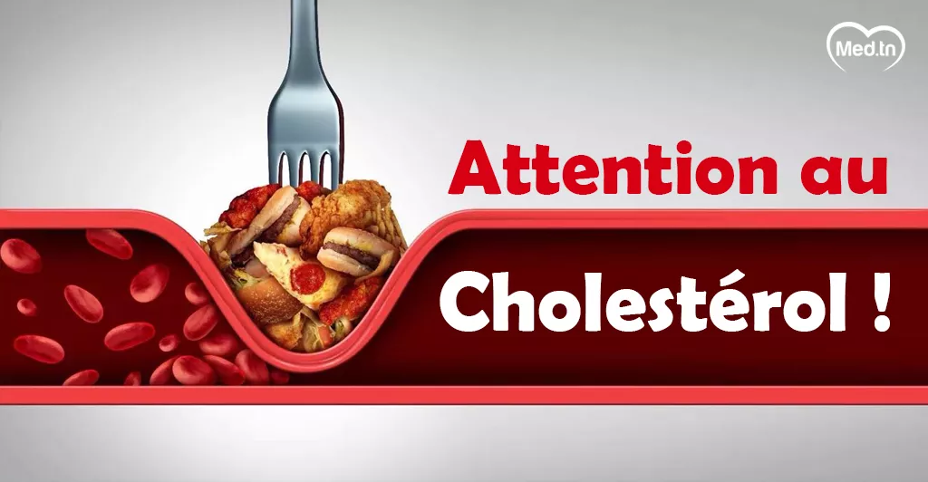 Attention au Cholestérol !