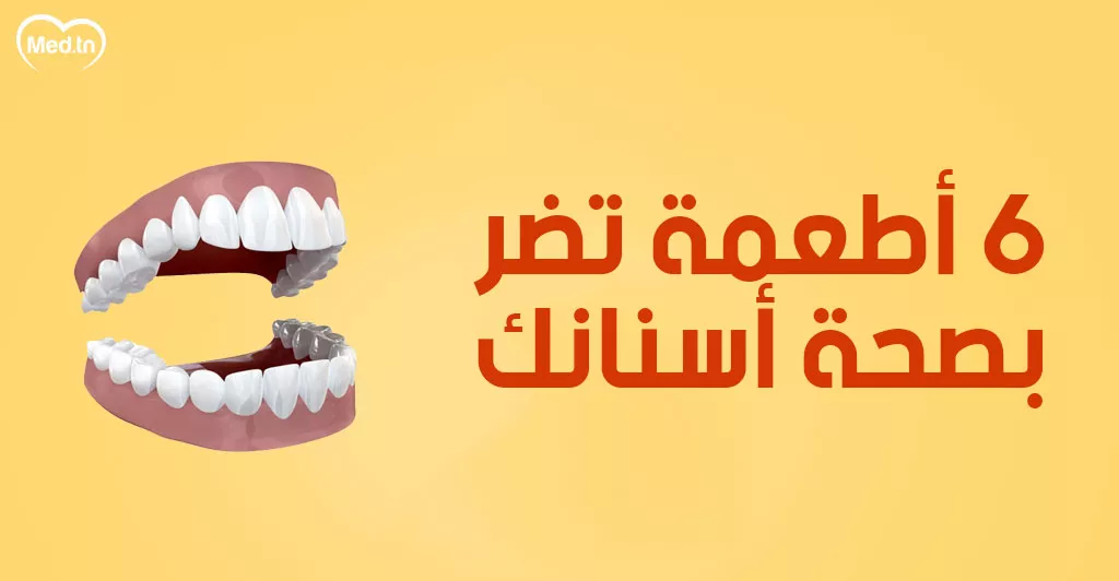 6 أطعمة تضر بصحة أسنانك