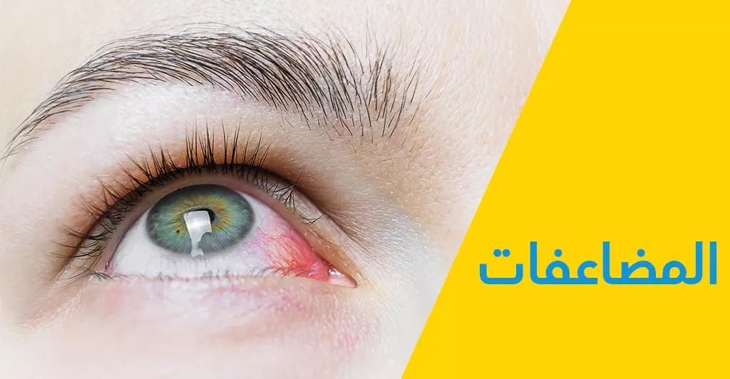 ماهو مرض السكّري في العينين وماهي أعراضه 