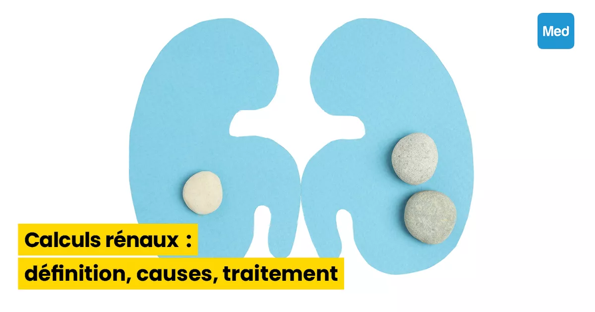 Calculs rénaux : définition, causes, traitement