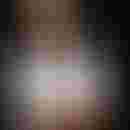 Dr Tadili Houda Dermatolog