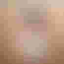 Dr Tadili Houda Dermatologue