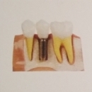 الدكتور لراكي يوسف طبيب أسنان