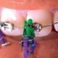 Dr BEN SALEM AYMEN Orthodontiste