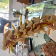 Dr Ben Amor Sadok Neurosurgeon