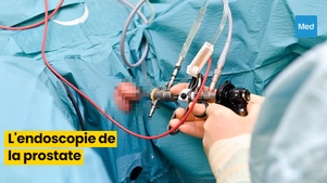 Comprendre l'Endoscopie de la Prostate