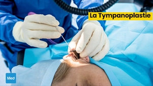 La Tympanoplastie : Restaurer l'Audition, Retrouver la Qualité de Vie