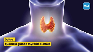 Goitre : quand la glande thyroïde s'affole