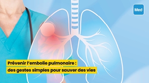 Prévenir l'embolie pulmonaire : des gestes simples pour sauver des vies
