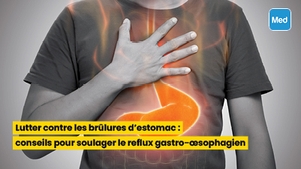 Brûlures d'estomac : conseils pour soulager le reflux gastro-œsophagien