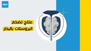علاج تضخم البروستات بالبخار
