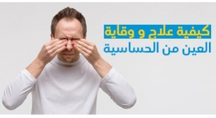 Makaleler كيفية علاج و وقاية العين من الحساسية
