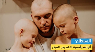 Makaleler السرطان: أنواعه وأهمية التشخيص المبكر