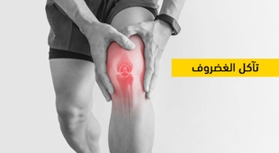 Magazine تآكل الغضروف