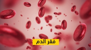Makaleler فقر الدم
