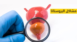 Magazine مشاكل البروستاتا