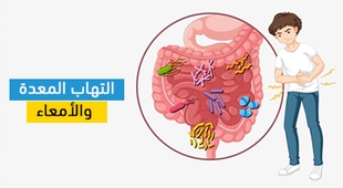 Makaleler التهاب المعدة والأمعاء