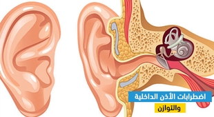 المجلة الطبية اضطرابات الأذن الداخلية والتوازن