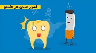المجلة الطبية أضرار التدخين على الأسنان