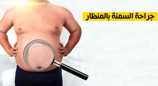 Makaleler جراحة السمنة بالمنظار
