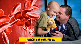 المجلة الطبية سرطان الدم لدى الأطفال