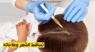 Magazine تساقط الشعر وعلاجاته