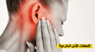 Makaleler التهابات الأذن الخارجية