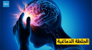 المجلة الطبية الجلطة الدماغية: التشخيص والعلاج والوقاية