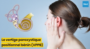 المجلة الطبية Le Vertige Paroxystique Positionnel Bénin (VPPB)
