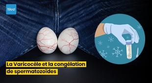 المجلة الطبية La Varicocèle et la Congélation de Spermatozoïdes : Préservation de la Fertilité avant une Intervention