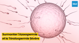 Magazine Congélation de Sperme : L'Espoir pour Surmonter l'Azoospermie et la Tératospermie Sévère