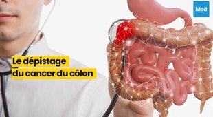 المجلة الطبية Le Dépistage du Cancer du Côlon : La Clé de la Prévention et de la Survie