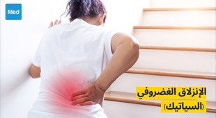Magazine الإنزلاق الغضروفي (السياتيك): الأسباب والأعراض والتشخيص والعلاج