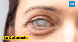 المجلة الطبية Comprendre la Cataracte : Symptômes, Causes, Traitement et Prévention