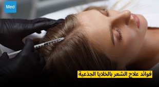 Makaleler فوائد علاج الشعر بالخلايا الجذعية