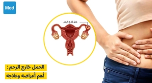 المجلة الطبية الحمل خارج الرحم: أهم أعراضه وعلاجه