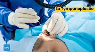 المجلة الطبية La Tympanoplastie : Restaurer l'Audition, Retrouver la Qualité de Vie