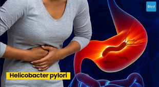 المجلة الطبية Helicobacter pylori : Comprendre, Diagnostiquer et Traiter