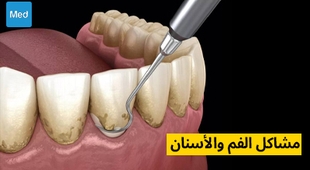 المجلة الطبية مشاكل الفم والأسنان 