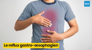 المجلة الطبية Reflux gastro-œsophagien (RGO) : causes, symptômes et traitement