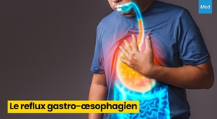 المجلة الطبية Le Reflux Gastro-Œsophagien (RGO) : comprendre et soulager ce trouble digestif fréquent