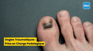 المجلة الطبية Ongles Traumatiques : Prise en Charge Podologique