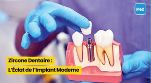 المجلة الطبية Zircone Dentaire : L'Éclat de l'Implant Moderne