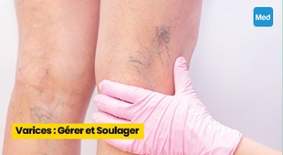 المجلة الطبية Varices : Gérer et Soulager