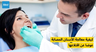 Magazine كيفية معالجة الأسنان المصابة عوضا عن اقتلاعها