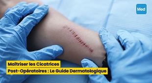 المجلة الطبية Maîtriser les Cicatrices Post-Opératoires : Le Guide Dermatologique