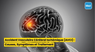 المجلة الطبية Accident Vasculaire Cérébral Ischémique (AVCI) : Causes, Symptômes et Traitement