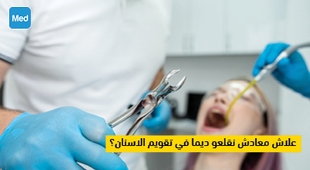 Magazine علاش معادش نقلعو ديما في تقويم الاسنان؟
