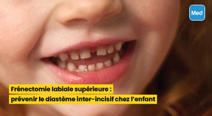المجلة الطبية Frénectomie labiale supérieure  prévenir le diastème chez l'enfant